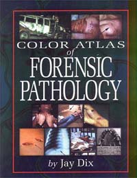 Color Atlas of Forensic Pathology, by Jay Dix