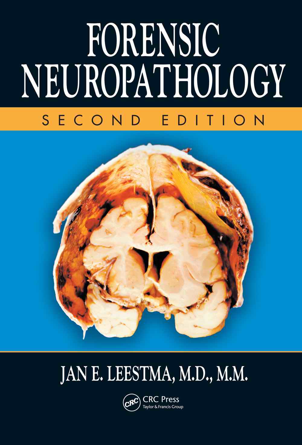 Forensic Neuropathology, Second Edition by Jan E. Leestma